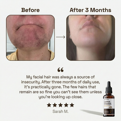 Natural Cyperus Hair Reducing Oil