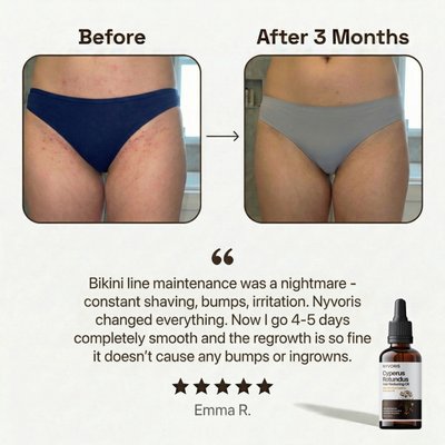 Natural Cyperus Hair Reducing Oil