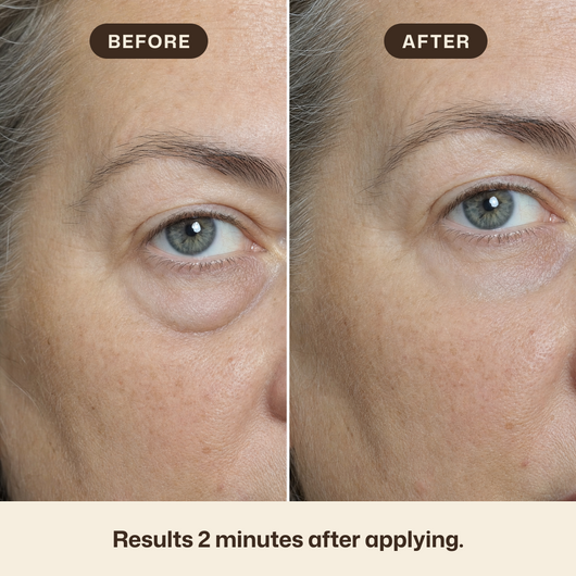 Instant Eye Tightener