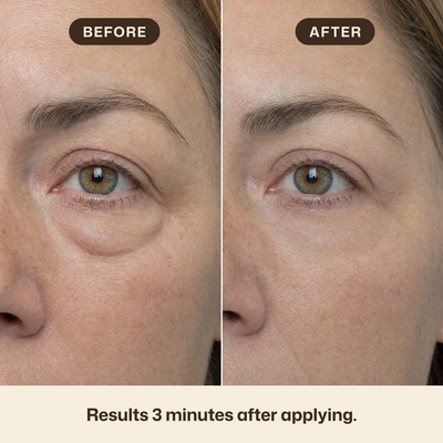 Instant Eye Tightener