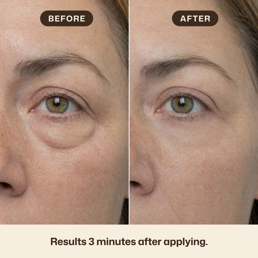 Instant Eye Tightener