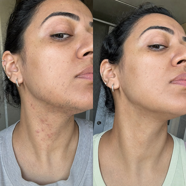 Alyssa T., 34