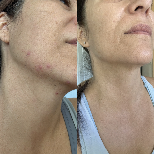 Terri A., 55